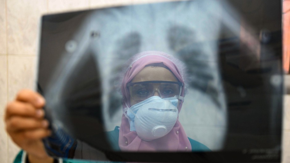 An Egyptian doctor wearing two protective masks checks a patient's lung X-ray at the infectious diseases unit of the Imbaba hospital in the capital Cairo, during the COVID-19 coronavirus pandemic crisis.