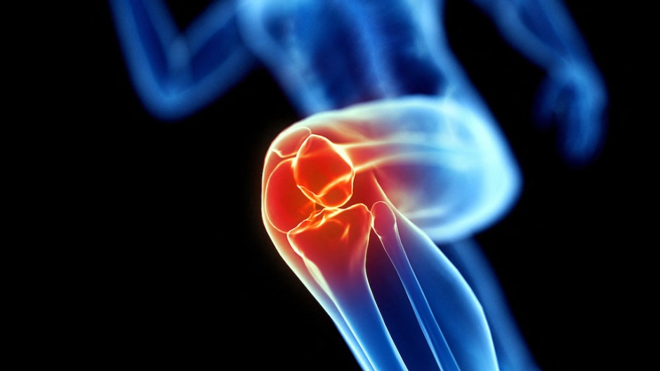 File: An illustration of a runner's knee. AFP/Sebastian Kaulitzki/Science Photo Library