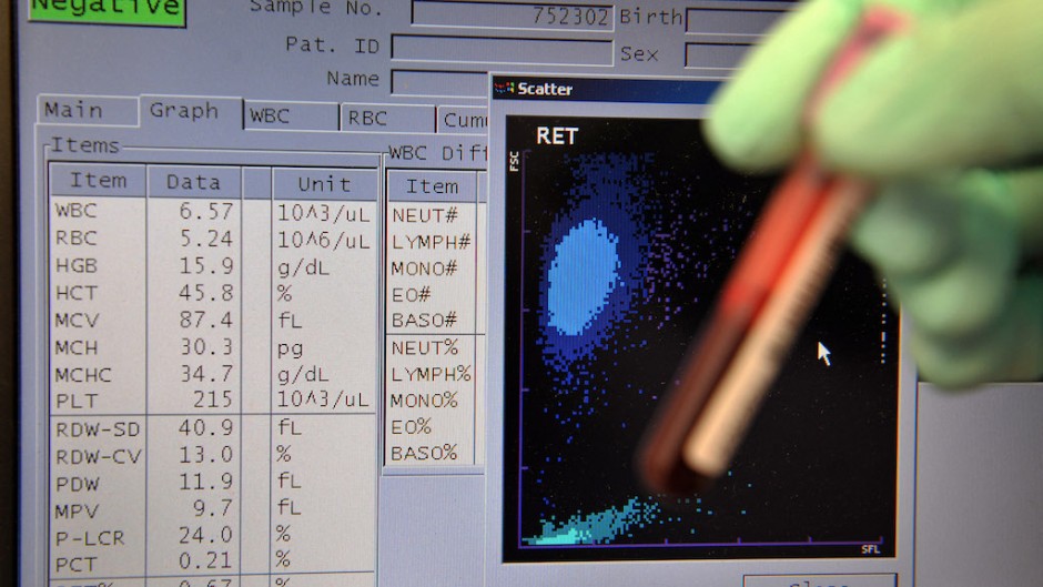 File: Swiss Laboratory for Doping Analysis' Neil Robinson displays the results of a blood sample test. AFP/Fabrice Coffrini