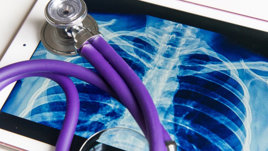 File: An X-Ray on a tablet with a stethoscope. Hans Lucas via AFP/Riccardo Milani