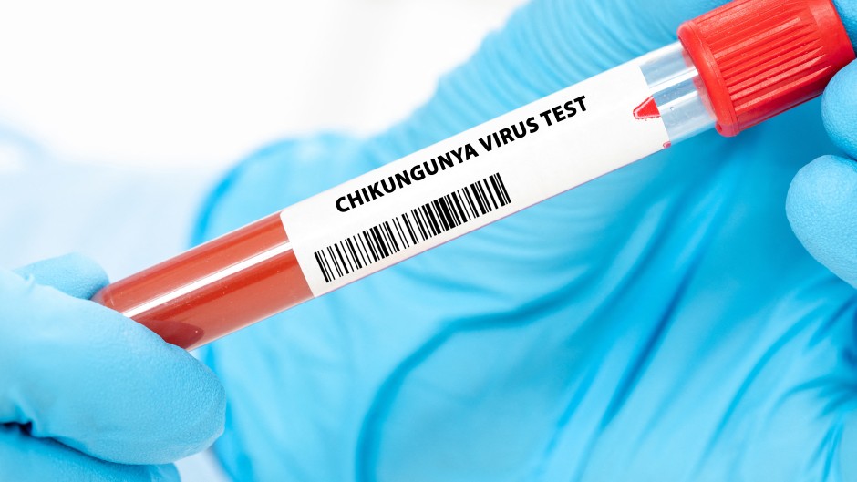 Chikungunya virus test