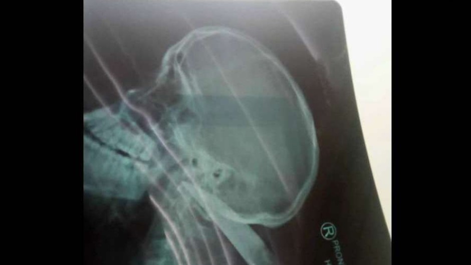 The pupil's X-Ray showing the knife.