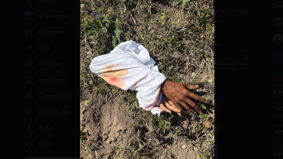 Fake severed hands found in field