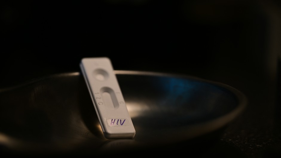 HIV" is written on a rapid test at the Berlin AIDS service organization. Photo: Sebastian Gollnow/dpa (Photo by Sebastian Gollnow / DPA / dpa Picture-Alliance via AFP)
