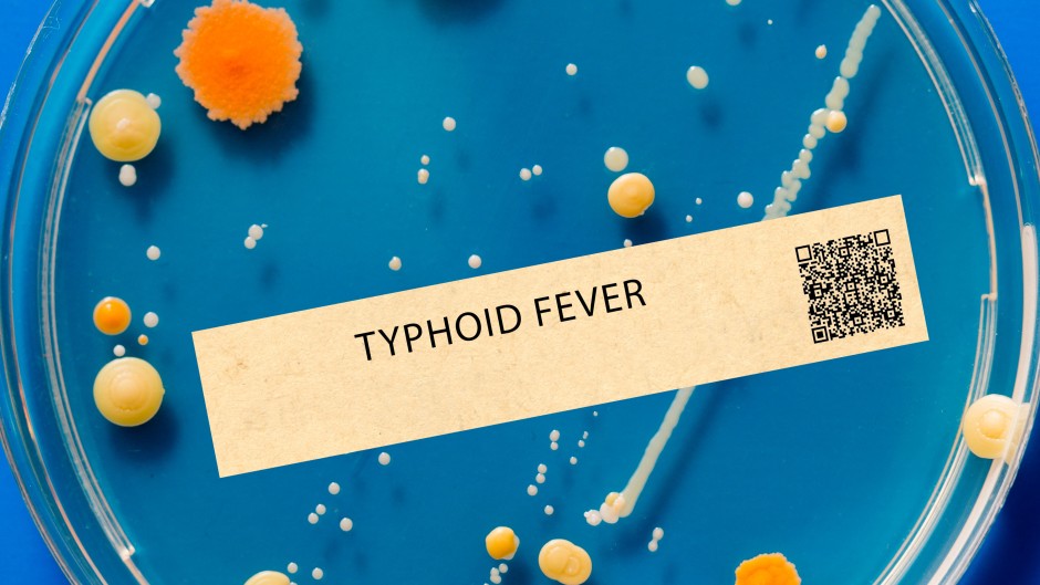 Typhoid fever. This is a bacterial infection that causes fever, abdominal pain, and diarrhoea. PhotoPhoto by WLADIMIR BULGAR/SCIENCE PHOTO LI / WBU / SCIENCE PHOTO LIBRARY VIA AFP 