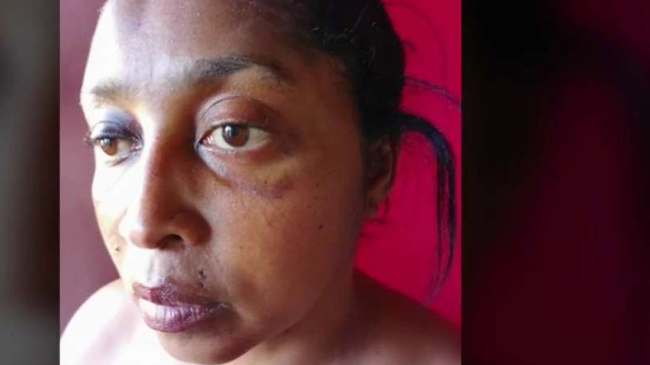 Alida Dudley was allegedly assaulted by police officers.