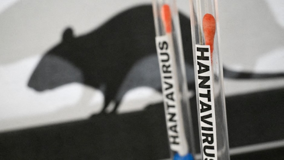 File: Illustration of a hantavirus testing concept. Joao Luiz Bulcao/Hans Lucas via AFP 