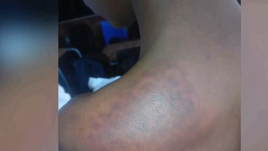 Erasmus Monareng School Assault