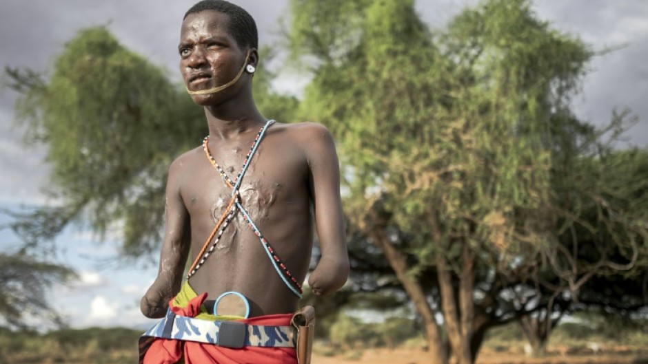 Lisoka Lesasuyan was 13 in 2015 when an unexploded bomb detonated on a field used for mortar practice by British and Kenyan soldiers