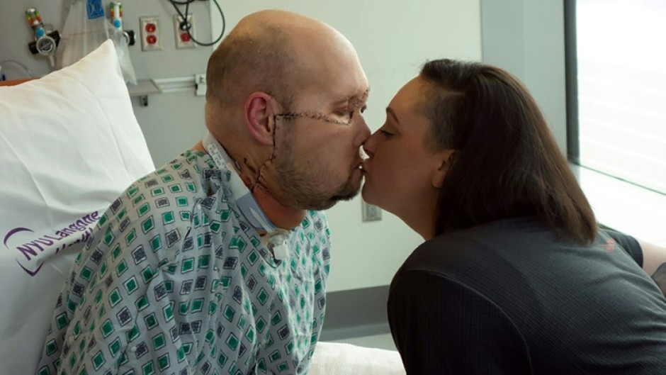 Aaron James (L) kisses his wife Meagan while he recovers from the first whole-eye and partial face transplant, at NY Langone Health in New York