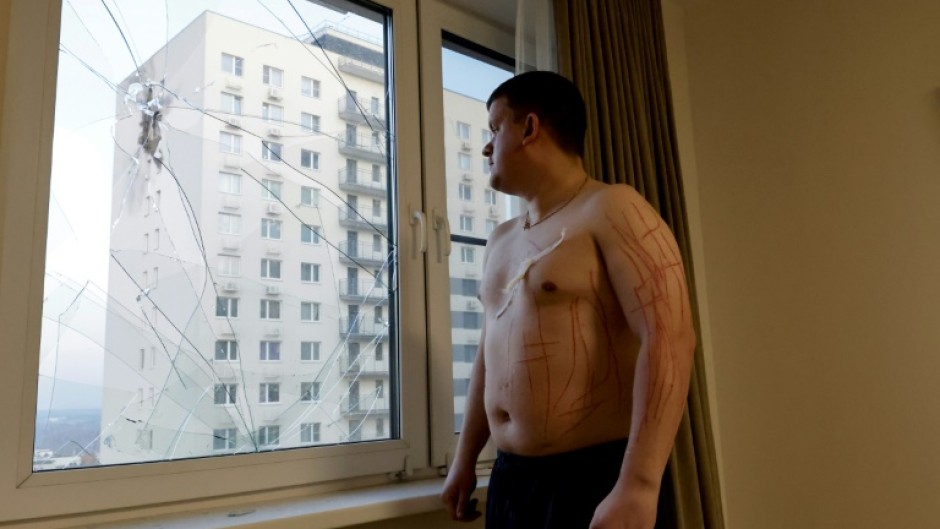 Russia has previously ruled out partial ceasefires, calling it a ploy by Kyiv to regroup and rearm