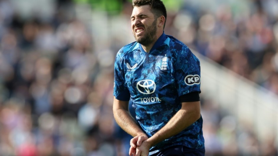 England's Jamie Overton