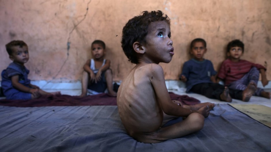 Gaza is suffering 'man-made... mass starvation', according to the head of the World Health Organization, Tedros Adhanom Ghebreyesus