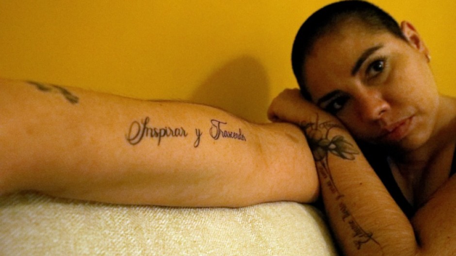 Samara Martínez, 30, who suffers from terminal kidney failure and is leading a campaign to legalize euthanasia in Mexico, seen at her home on October 18, 2025