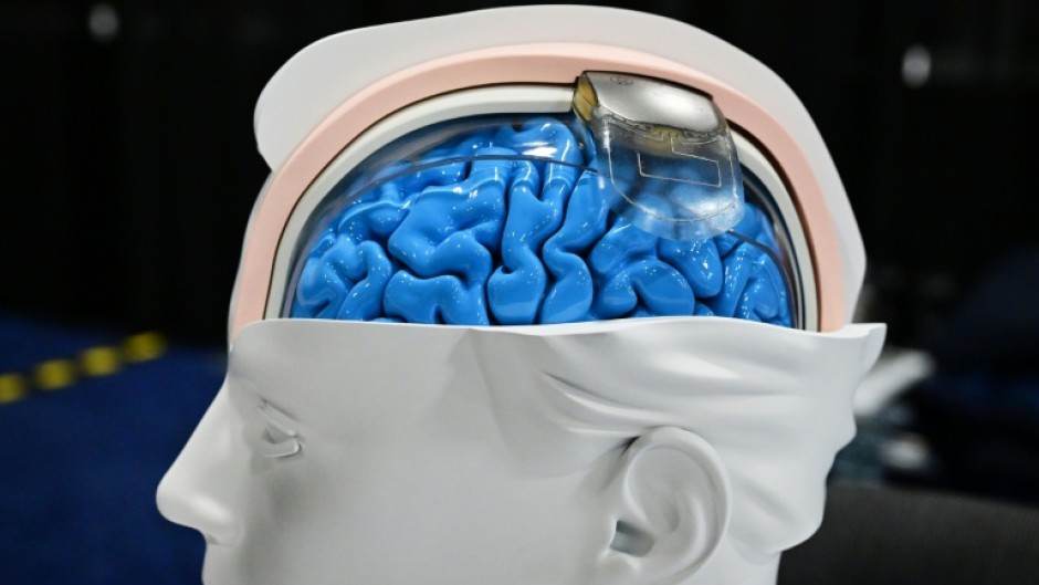 Are brain implants the tech of the future? Some think neurotech could be as revolutionary as AI