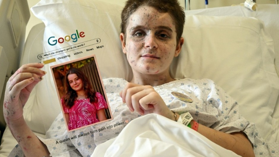 Bazzi's daughter Aseel shows a portrait of herself taken before she was gravely wounded in the Israeli strike