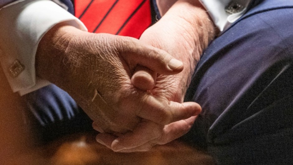 US President Donald Trump blames aspirin for bruises on his hand