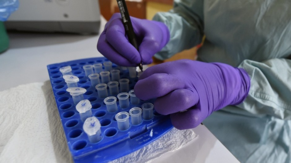 A health official works at the Lassa Fever Research and Control in Irrua Specialist Teaching Hospital in midwest Nigeria, in 2018
