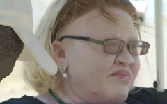 One of the delegates, Nomaphelo Ntini, who also lives with albinism, described her life experience as far from easy.