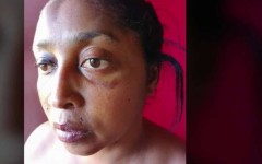 Alida Dudley was allegedly assaulted by police officers.