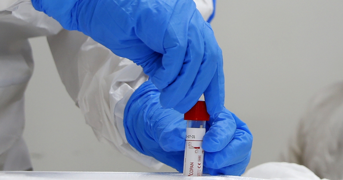 Image result for Cape Bio Pharm corona virus kit
