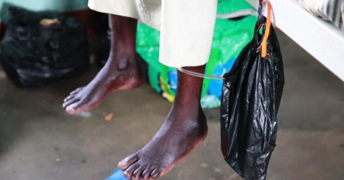 Uganda rolls out new Fistula campaign eNCA