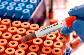 File: A Hepatitis blood test. (WLADIMIR BULGAR/SCIENCE PHOTO LI / WBU / Science Photo Library via AFP)