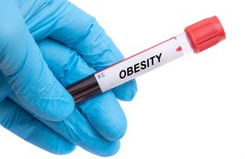 Obesity