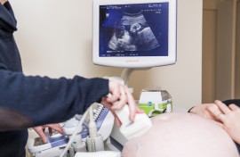 File: A doctor doing an ultrasound examination of a pregnant woman. Jasper Jacobs/Belga/AFP