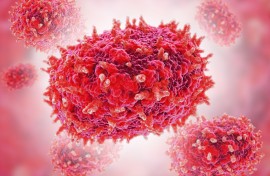 File: Mpox (previously monkeypox) virus particles. SIA/Science Photo Library via AFP