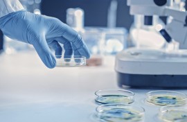 File: Scientist culturing bacteria in petri dishes in a laboratory. GPR/Science Photo Library via AFP