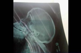 The pupil's X-Ray showing the knife.