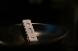 HIV" is written on a rapid test at the Berlin AIDS service organization. Photo: Sebastian Gollnow/dpa (Photo by Sebastian Gollnow / DPA / dpa Picture-Alliance via AFP)