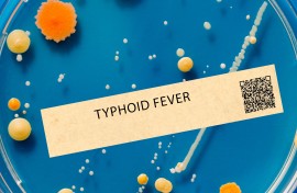Typhoid fever. This is a bacterial infection that causes fever, abdominal pain, and diarrhoea. PhotoPhoto by WLADIMIR BULGAR/SCIENCE PHOTO LI / WBU / SCIENCE PHOTO LIBRARY VIA AFP 