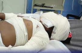 A two-year-old girl is fighting for her life after being stabbed 15 times.