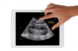 Conceptual image of a kidney disease diagnosis. SAMUNELLA/Science Photo Library via AFP