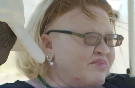 One of the delegates, Nomaphelo Ntini, who also lives with albinism, described her life experience as far from easy.