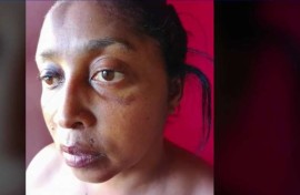 Alida Dudley was allegedly assaulted by police officers.