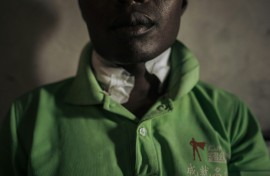 Innocent Kasereka, 30, says he was attacked and suffered cuts to his neck when he became caught in the middle of fighting in eastern DR Congo