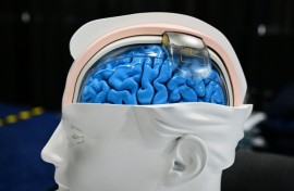 Are brain implants the tech of the future? Some think neurotech could be as revolutionary as AI