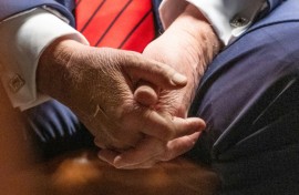 US President Donald Trump blames aspirin for bruises on his hand