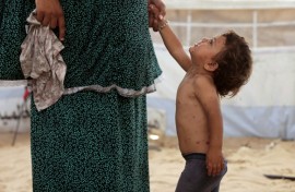 UNICEF said health officials had already recorded more than 9,300 suspected cases of chickenpox across Gaza in early July