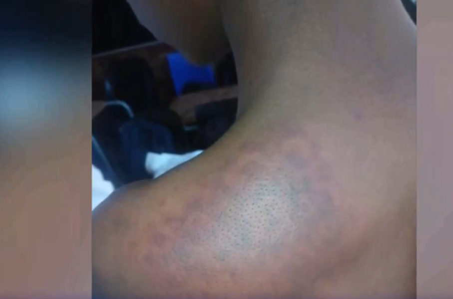 Erasmus Monareng School Assault