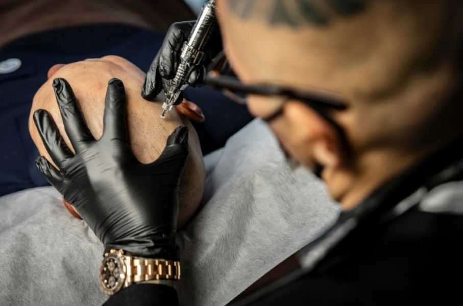 Tattoo artist Remy performing a scalp micropigmentation procedure on client Koki Hatanaka at his studio in Ginowan