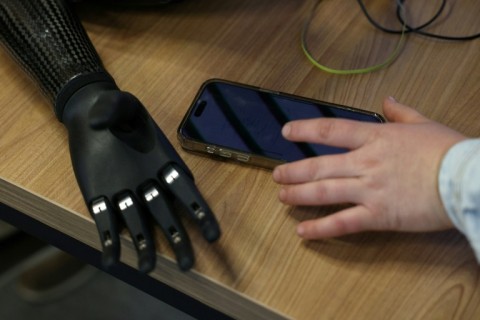 A bionic prosthetic hand of Valery Kucherenko lies on a table 