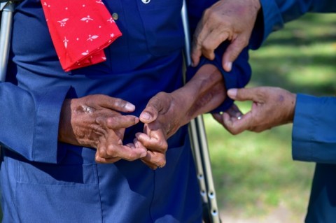 Survivor Maliki Doloh was injured in the October 2004 crackdown when scores of Muslim protesters suffocated in Thai army trucks