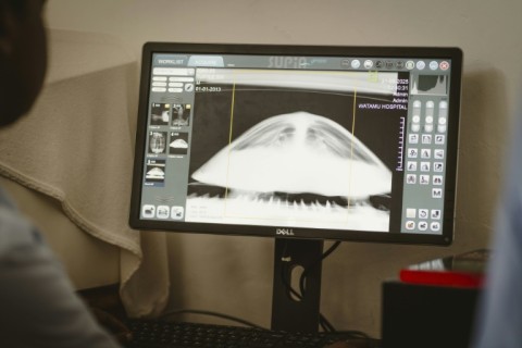 X-ray of a turtle that consumed plastic and is unable to dive