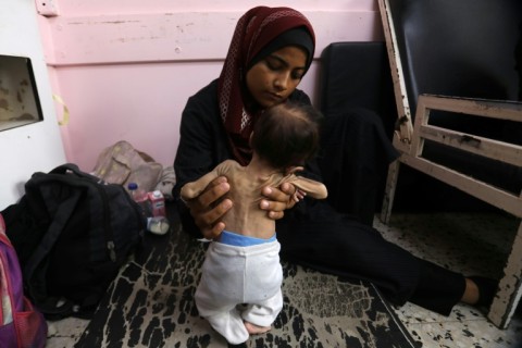 Yasmine, a 22-year-old Palestinian mother, holds her malnourished tw-months-old daughter Teen as they await treatment at the Nasser hospital in Khan Yunis