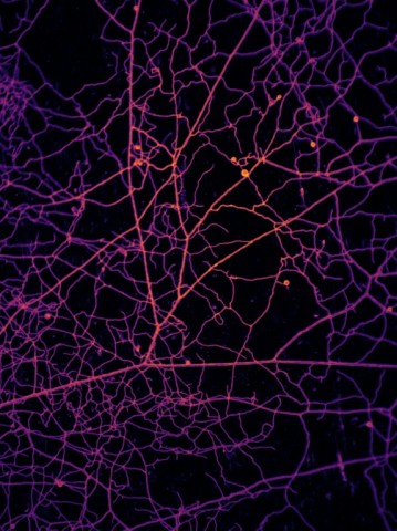 A microscopic image of network formed by arbuscular mycorrhizal fungi
