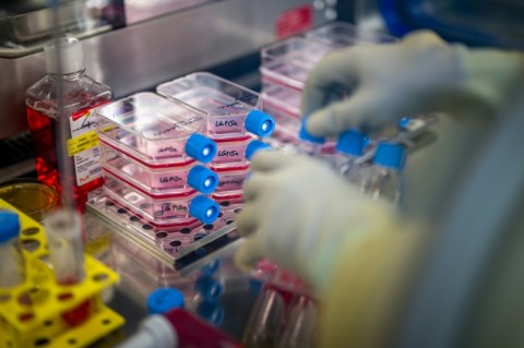 A long rehabilitation process follows the complex graft procedure